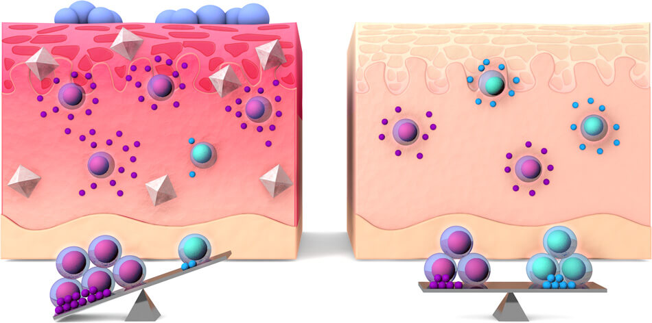Infographic salt and the immune system / TU Munich, Zielinski CE / Daniela Leitner