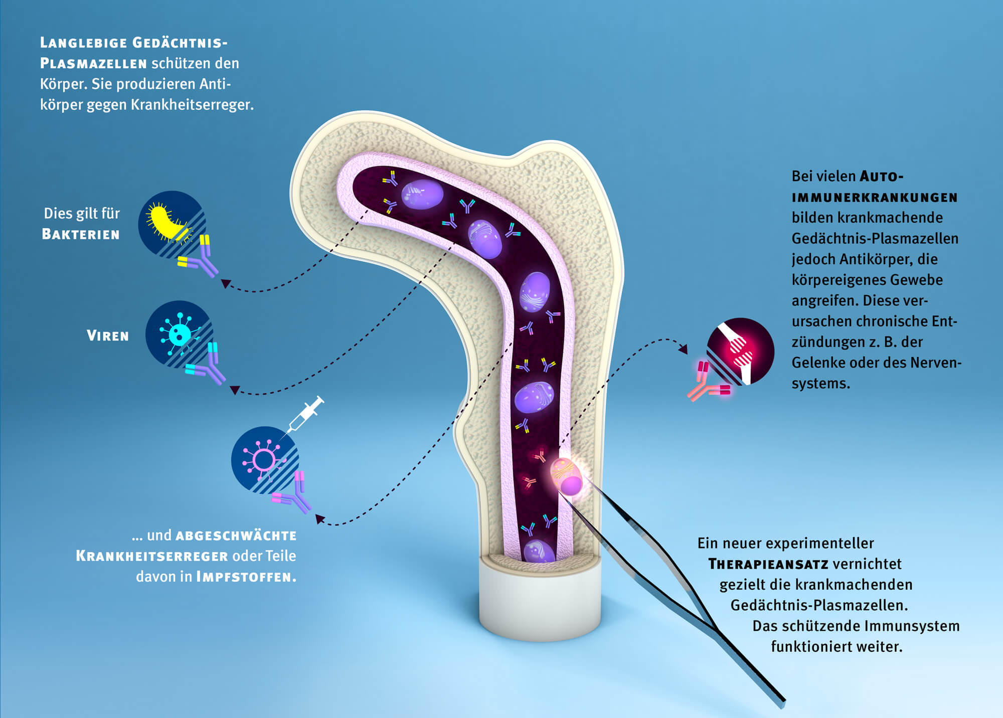 Langlebige Gedächtnis-Plasmazellen und Auto-Immunerkrankungen | Infografik: Daniela Leitner